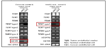 Expression of endothelial cell makers between normal anc cancer endothelial cells isolated from human breast cancer tissues