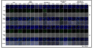 Si-Azo-CD-PEG에 의한 apoptotic cells의 confocal image