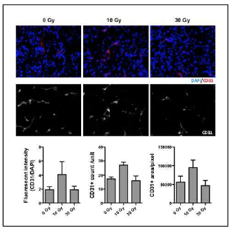 방사선 치료군의 종양 조직 내 혈관내피세포 마커 (CD31)의 형광염색 후 발현 분석