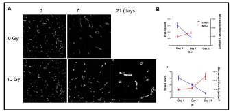 환자유래 glioma stem like cell를 뇌내에 주입하여 형성한 정위뇌암에 방사선을 조사하고 방사선 조사 유무에 따른 종양 크기별 종양 내 혈관변화 분석