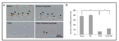 뇌암조직환경 방사선 민감도 조절제 후보 sodium butyrate의 정상 뇌조직 방사선 민감도 평가