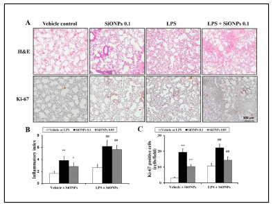SiONP의 폐독성 및 염증 영향 평가 (A) 조직분석, (B) 염증분석, (C) 폐세포 증식마커 분석
