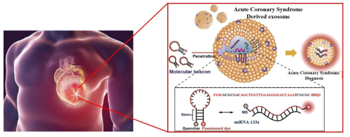 MB-133a를 이용한 급성 관상동맥증후군 조기 진단