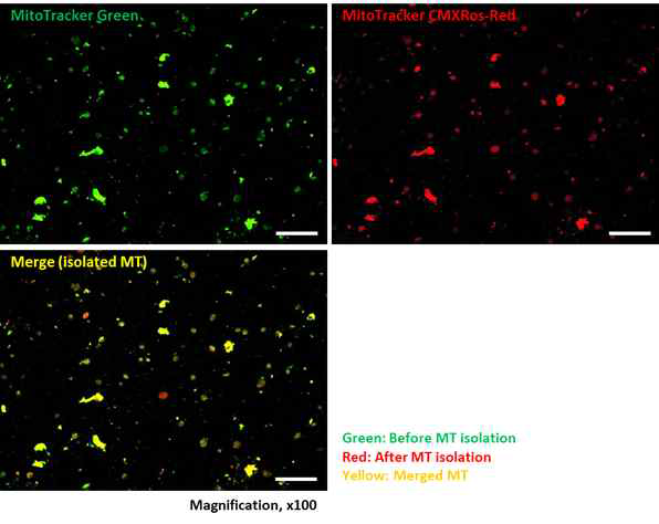 분리 후 막전위가 유지되는 미토콘드리아의 형광이미지 분석.