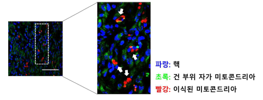 손상된 건 부위의 이식된 미토콘드리아 잔존 확인