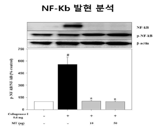 NF-kB 발현 기전 분석