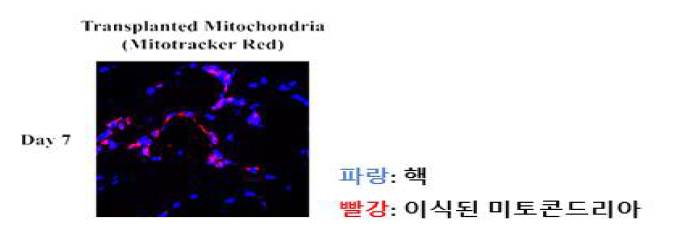 중증하지허혈 부위에 이식된 미토콘드리아의 잔존 확인