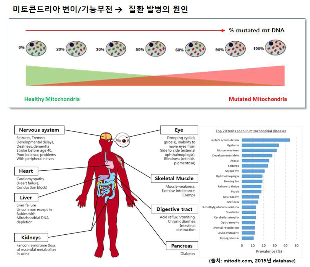 미토콘드리아 기능부전의 원인 및 미토콘드리아 원인성 질환 발병률