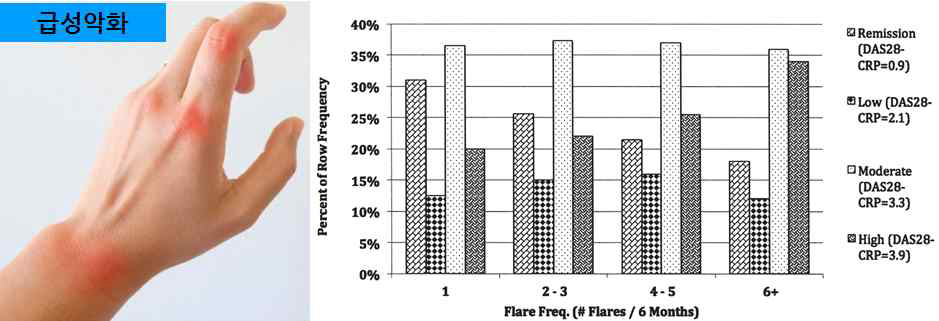 류마티스 관절염의 급성 악화 및 빈도
