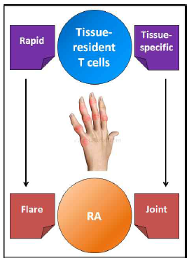 조직 상주 T세포와 류마티스 관절염의 상관성