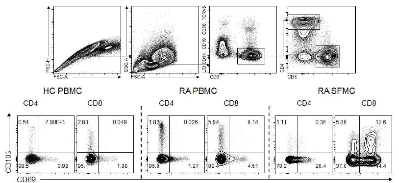 류마티스 관절염 환자의 관절액 조직 상주 T 세포의 표현형 (CD69+CD103+ T cell) HC; healthy control, RA; rheumatoid arthritis, PBMC; peripheral blood mononuclear cell, SFMC; synovial fluid mononuclear cell