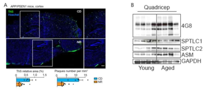 (A) Alzeheimer disease 모델인 APP/PSEN1 마우스에서 단백질 항상 성을 개선하는 NR을 투여하였을 시 뇌 내 Amyloid aggregation이 감소함4. (B) 노령화 마우스의 근육에서도 Aβ peptide가 축적되어 있음을 발견하였음 (unpublished data). 4G8: purified anti-β-Amyloid, 17-24 antibody