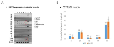 (A) Serotonin system in skeletal muscle by qPCR. (B) Serotonin level in skeletal muscle of C57BL/6J mouse. Standard chow diet vs. 8 weeks of high fat diet