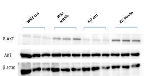 Tph1 KO C2C12 cell line에 서 AKT phosphorylation