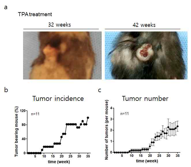 DMBA/TPA에 의한 암발생: papilloma vs SCC