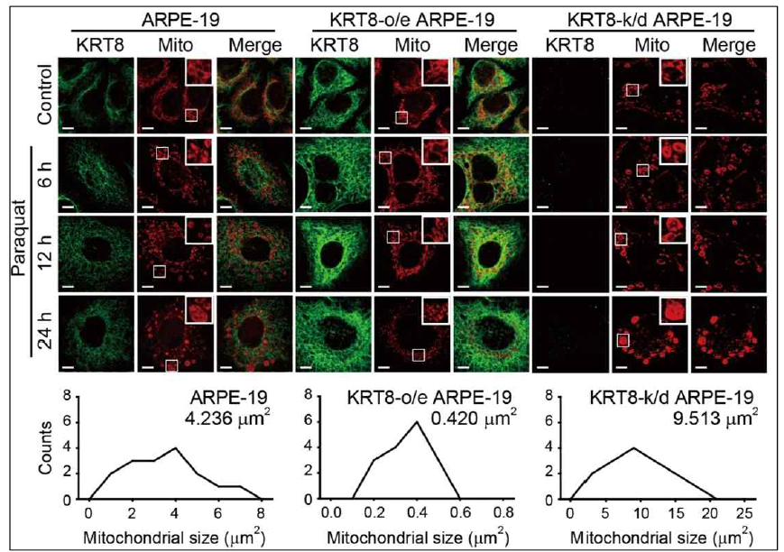 케라틴8의 발현량에 따른 산화스트레스에 의한 미토콘드리아 형태변화 관찰. 케라틴8 과발현/저발현 망막색소상피세포에 동일한 농도(400 μM)의 파라쿼트를 처리한 후 시간대에 따른 미토콘드리아의 형태를 관찰하기 위하여 MitoTracker Red로 미토콘드리아를 염색함. 케라틴8은 면역염색법을 이용해 녹색형광으로 표지