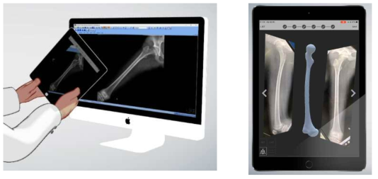 (좌)3차원 재구성 모바일 앱. 아이패드 앱으로 모니터의 엑스레이 영상을 촬영. (우)앱에서 재건한 3차원 형상 이미지
