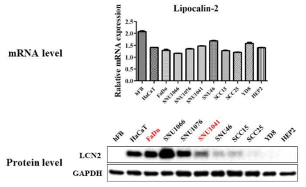 RT-PCR과 Western blot을 통해 확인한 두경부암 세포주내의 LCN2의 mRNA(위)와 단백질(아래) 발현율