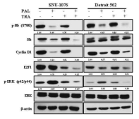 Inhibition of cell cycle and MAPK signaling pathways by the combination of PAL and TRA in HNC cells. HNC cells were treated with PAL and/or TRA for 72 h. Cell lysates were prepared and the levels of cyclin B1, E2F1, ERK, p-ERK, Rb, and p-Rb were analyzed by western blotting