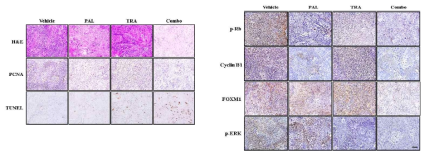 Antitumor effects of the combination of PAL and TRA in an HNC xenograft model. Histological analysis of xenograft tumor tissues by FOXM1 and p-ERK expression