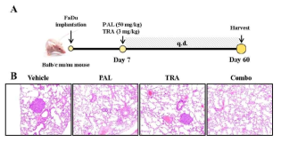Anti-cancer effects of the combination of PAL and TRA in HNC metastasis model. (A) Time schedule and treatment regimen. (B) Histological analysis of lung metastasis by H&E staining (n = 6)