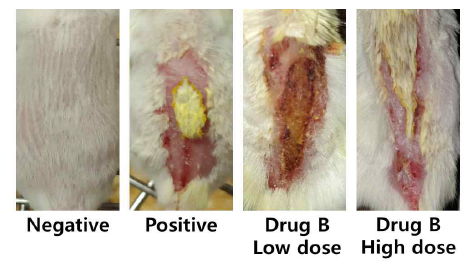 DNFB에 의한 아토피 피부염 동물 모델 확립. 약물 B