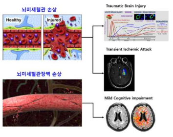 뇌미세혈관 손상은 외상성뇌손상, 일과성 허혈성 발작, 경도인지장애의 공통 병리현상임