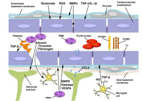 TBI환자의 뇌미세혈관 손상 현상