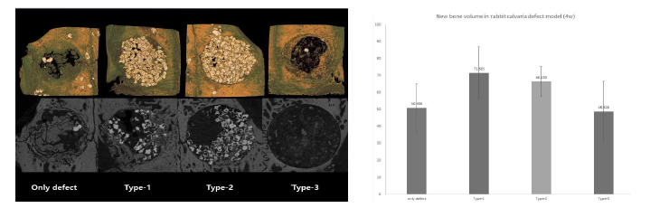 이식 4주 후 micro-CT 이미지 및 정량화