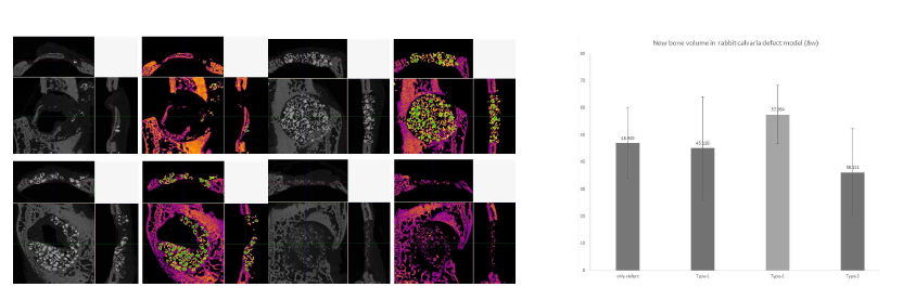 이식 8주 후 micro-CT 이미지 및 정량화