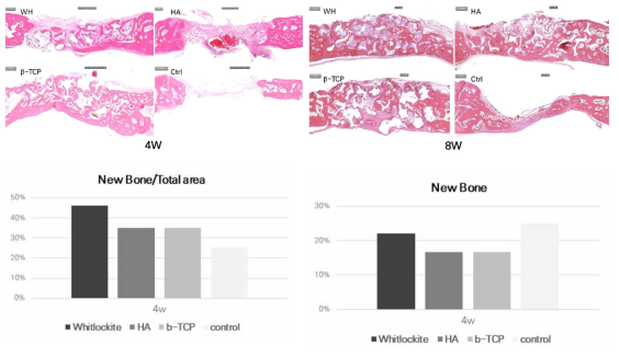 골이식재의 (상) 조직염색 이미지 및 (하) 경조직 면적비 (이식 4주/8주 후)