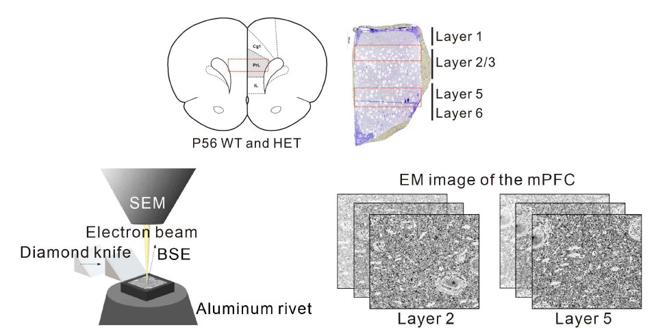 내측전두엽피질 계층별 세포 분석을 위한 전자현미경 기법 확립. 본 연구 참여연구원인 한국뇌연구원(KBRI) 이계주 박사팀 결과