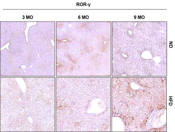 HFD 식이 유래 지방간 마우스 모델에서 ROR-γ의 발현 확인