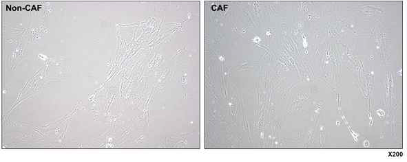 간암 환자 유래 CAFs 세포 모양