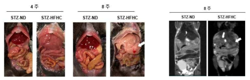 4주와 8주간 HFHC 섭취 마우스의 간과 MRI사진