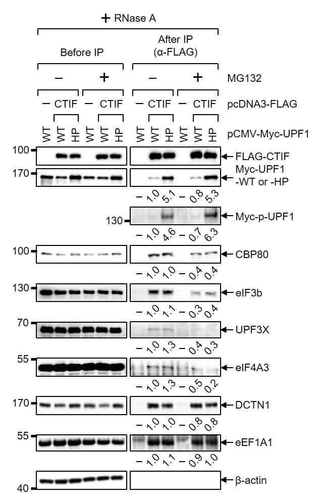 NMD와 CED 간의 결합을 보여주는 immunoprecipitation 결과