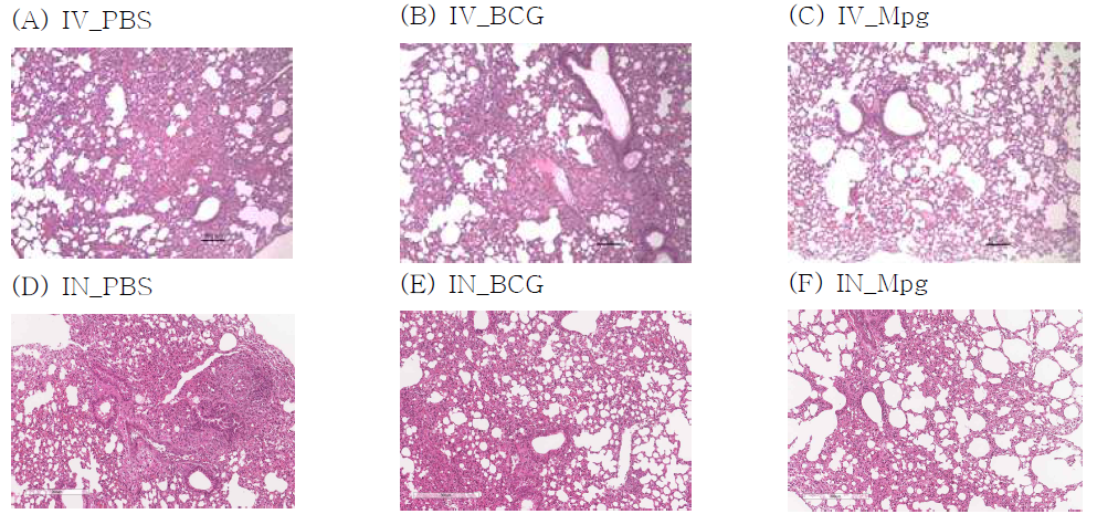BCG 및 Mpg 면역 후, Mab를 감염시킨(IV or IN) 마우스의 폐조직을 H&E로 염색하여 현미경으로 관찰한 결과