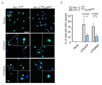 Inflammasome 활성에 의한 유전자형 간의 ASC speck formation 차이 확인