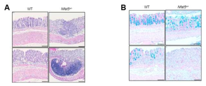 염증성 장염 유도 후, NFAT5+/+ 마우스와 NFAT5+/- 마우스 결장 조직의 조직학적 변화 관찰