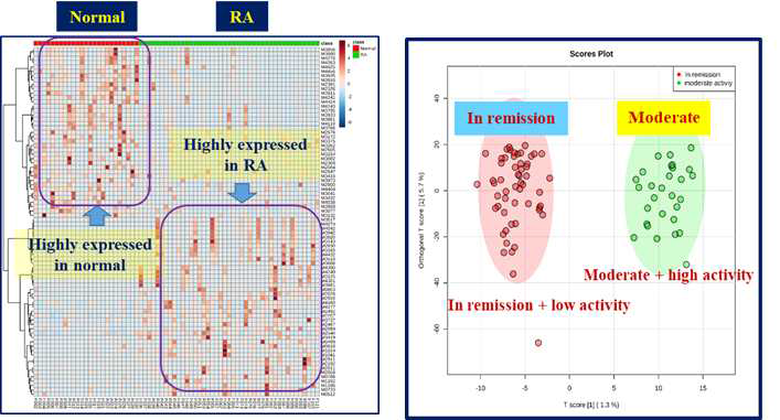 류마티스관절염 환자와 대조군의 metabolomics heatmap (좌)과 건강인, 골관절염 환자, 류마티스전단계, 류마티스관절염 환자의 대사체 분포 (우)