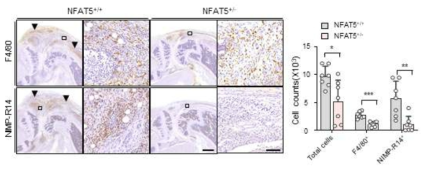 SAA가 투여된 NFAT5+/- 관절염 마우스의 관절 내 염증세포의 침윤 감소
