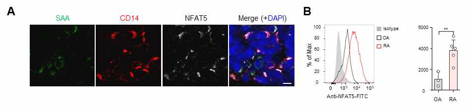 류마티스 관절염 환자의 CD14+ monocytes/macrophages에서 NFAT5의 발현