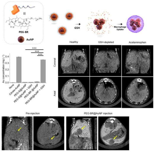 빌리루빈-금나노입자의 작용 모식도 및 급성간질환 모델에서 CT 조영제로서의 활용 결과