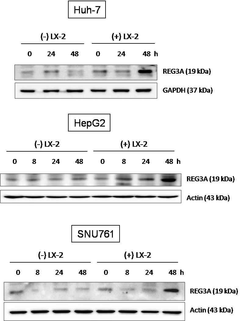 간세포암과 간성상세포의 coculture에 의하여 upregulation된 REG3A protein expression