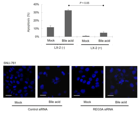 REG3A siRNA transfection 후 항진된 bile acid-induced HCC cell apoptosis (Confocal scan)