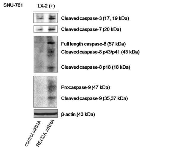 REG3A siRNA transfection후 apoptosis protein 변화