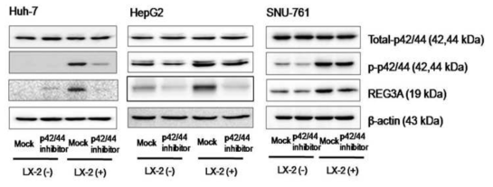 간세포암과 간성상세포의 coculture 조건에서 p42/44 inhibitor 처리 후 p42/44, REG3A 단백질 변화양상