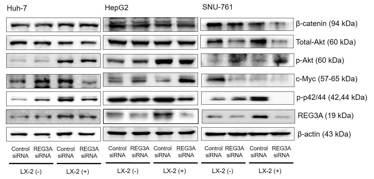 간세포암과 간성상세포의 coculture에 의하여 upregulation된 molecular pathway 발굴