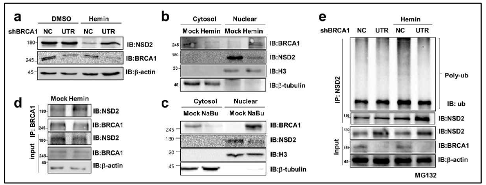 혈액암 분화 시 BRCA1의 핵 안으로 이동하며, NSD2 단백질 분해를 촉진함
