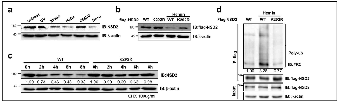 혈액암 분화 시 NSD2의 K292 잔기에 다중유비퀴틴화 발생